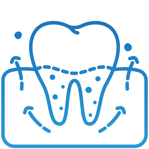 Gum care/ Gummy Smiles/ Surgeries